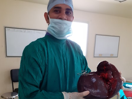 Spleenectomy Surgery in Shri Vatsalya Hospital